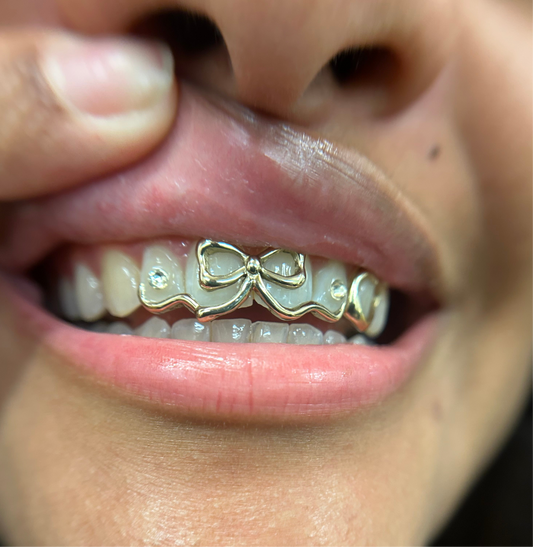 XL Bow Grillz