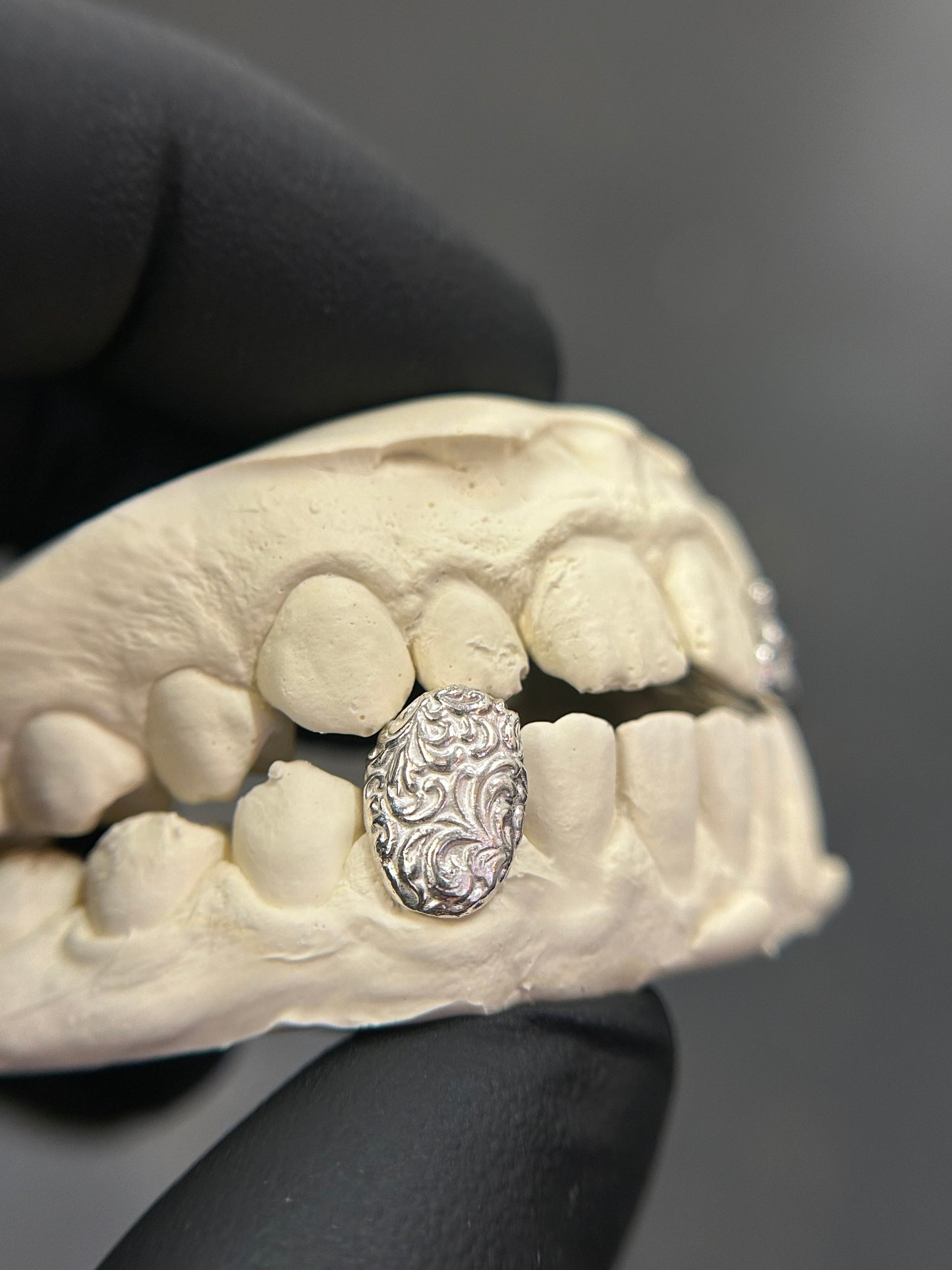 Single Filigree Cap