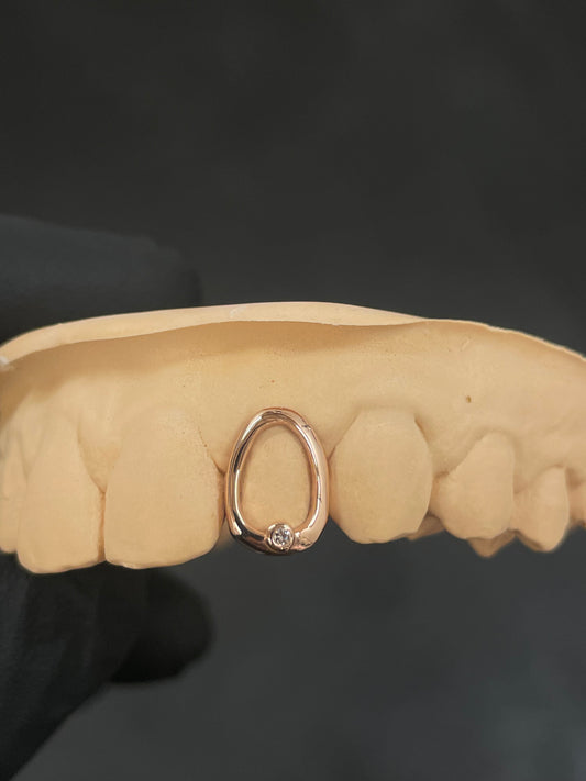 Single Diamond Window