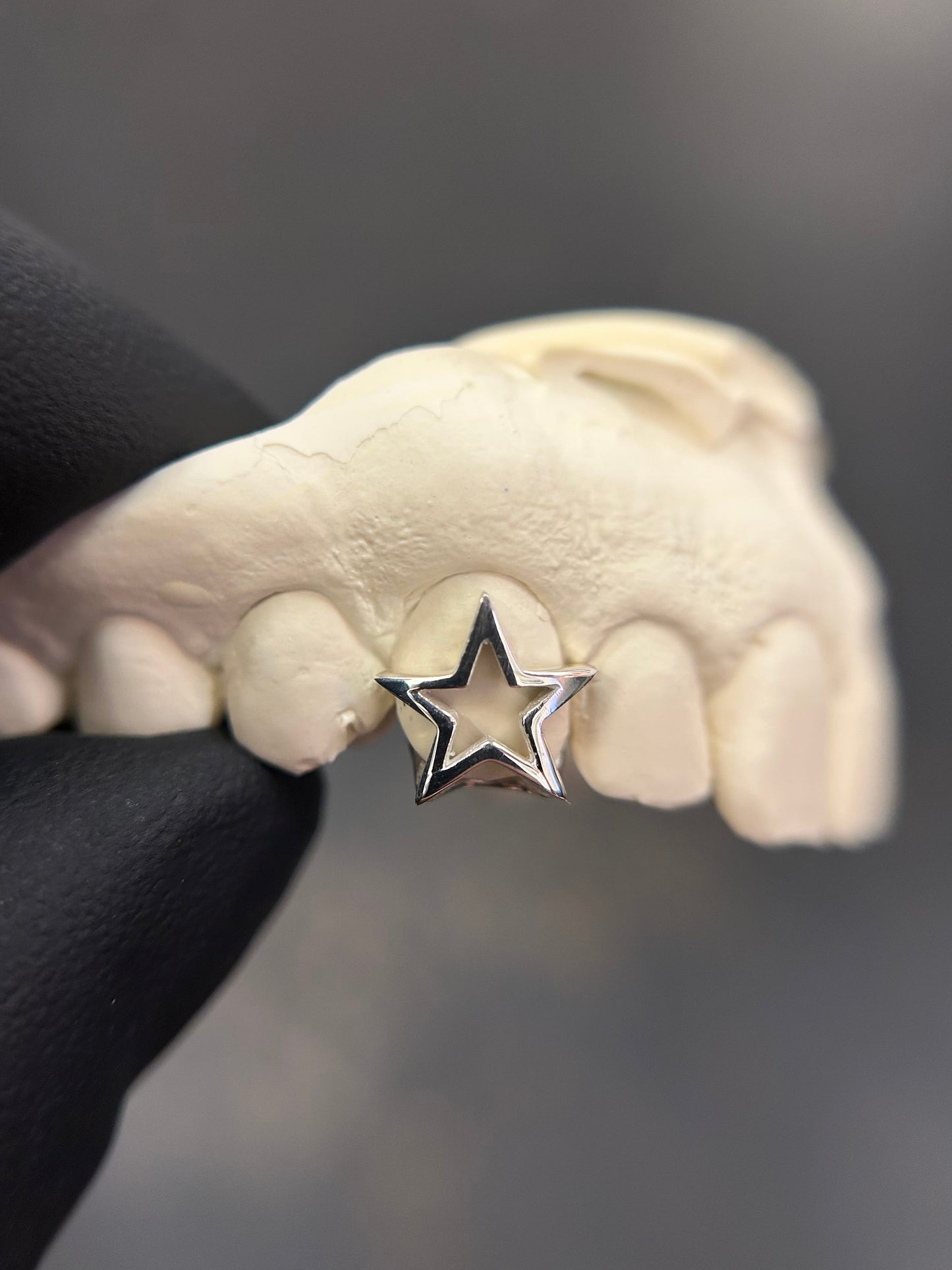 Open Star